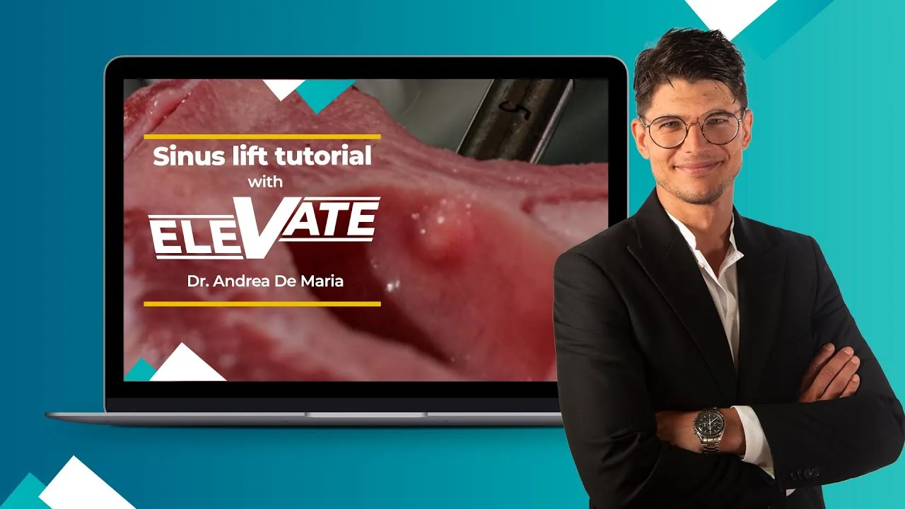 Tutoriel Kit Elevate — lire la vidéo