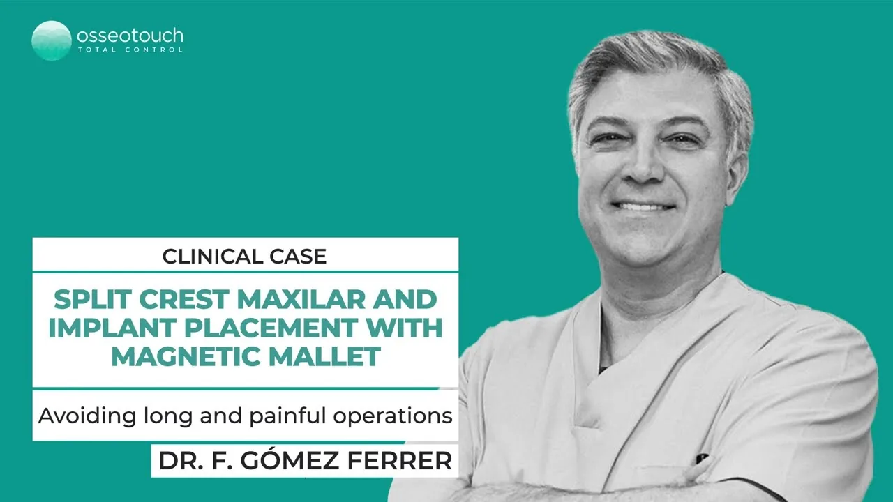 Dr Fernando Gómez-Ferrer — split crest maxillaire et pose d'implant au Magnetic Mallet