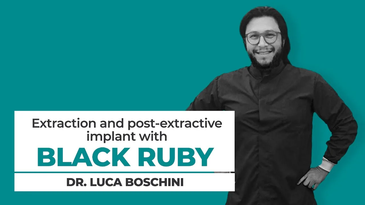 Cas clinique — préparation du site implantaire avec Black Ruby en pratique réelle