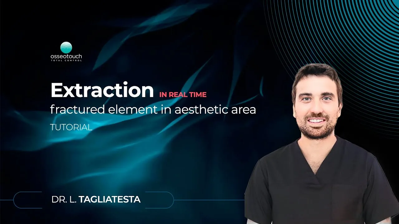 Tutorial Step by Step - Estrazione Magnetodinamica con Kit Estrazione Essential