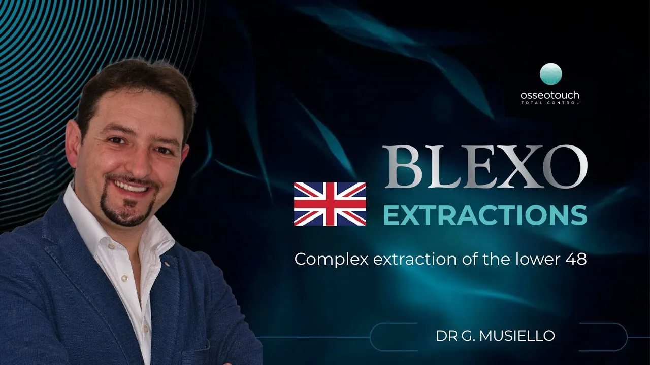 Cas clinique BLEXO — extraction complexe de la 48