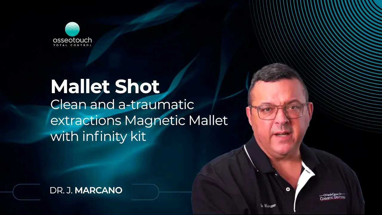 Webinaire en direct sur le Kit Essential et l'extraction atraumatique