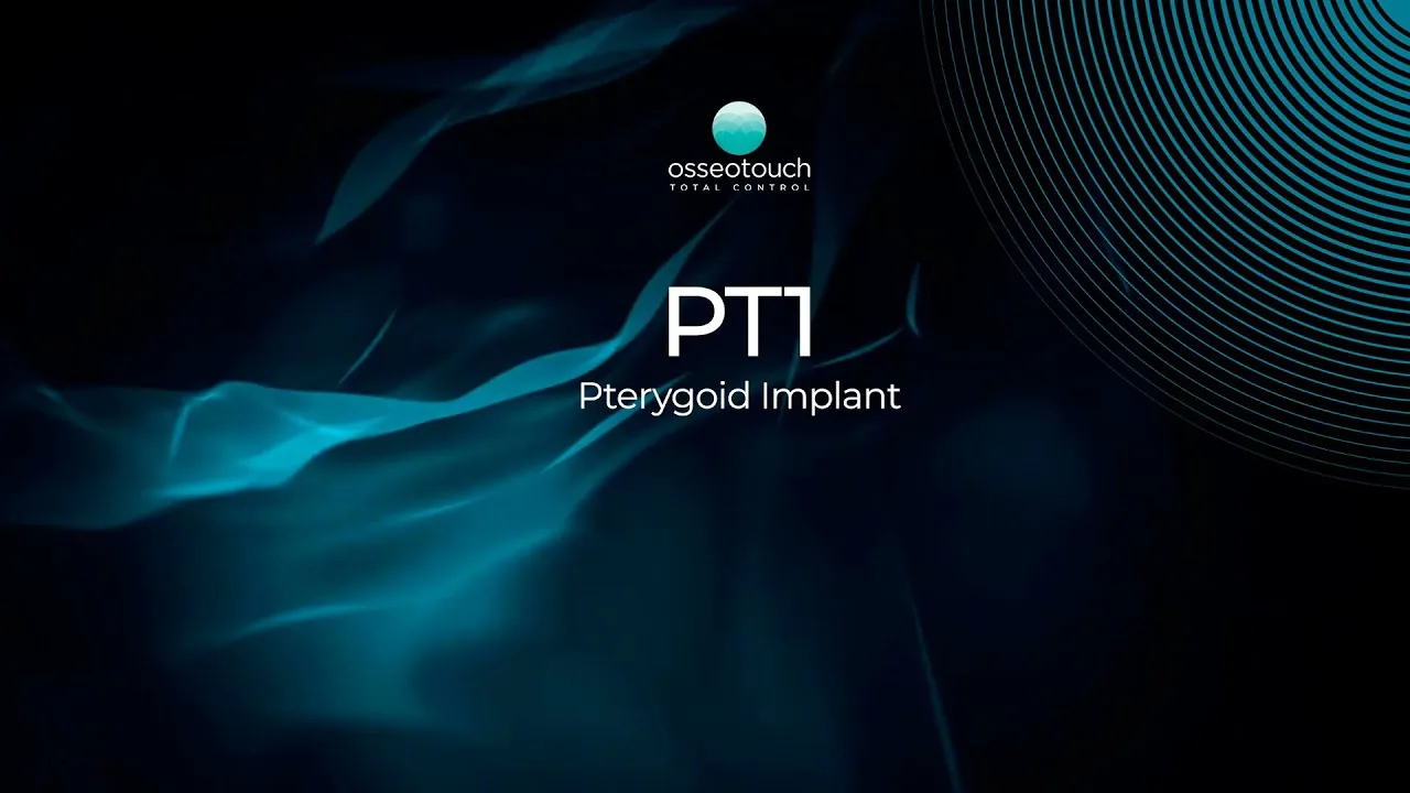 PT1 — animation 3D d'implant ptérygoïdien (OSSEOTOUCH)