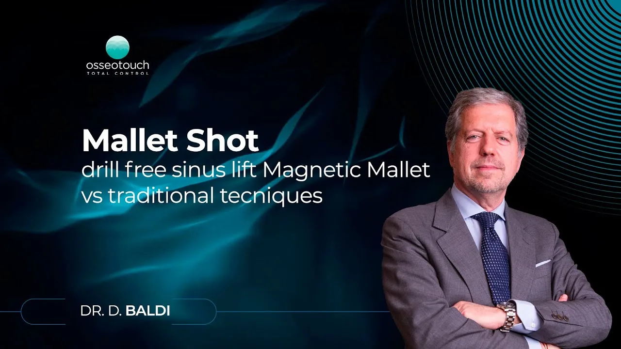 Webinar Dr. Baldi — Rotary bur-free sinus lift, Magnetic Mallet vs traditional techniques