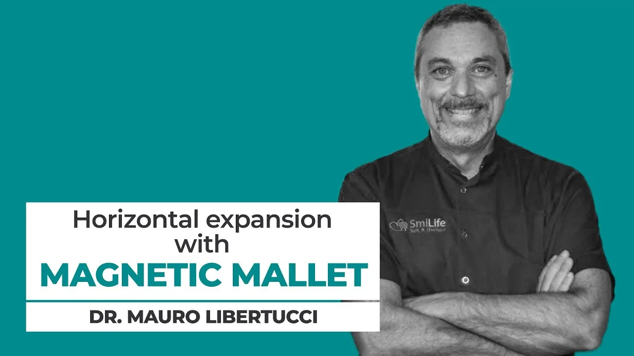 Dr M. Libertucci — split crest et élévation sinusienne simultanés au Magnetic Mallet