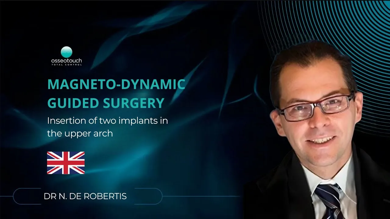 Chirurgie guidée magnétodynamique — pose de deux implants à l'arcade supérieure