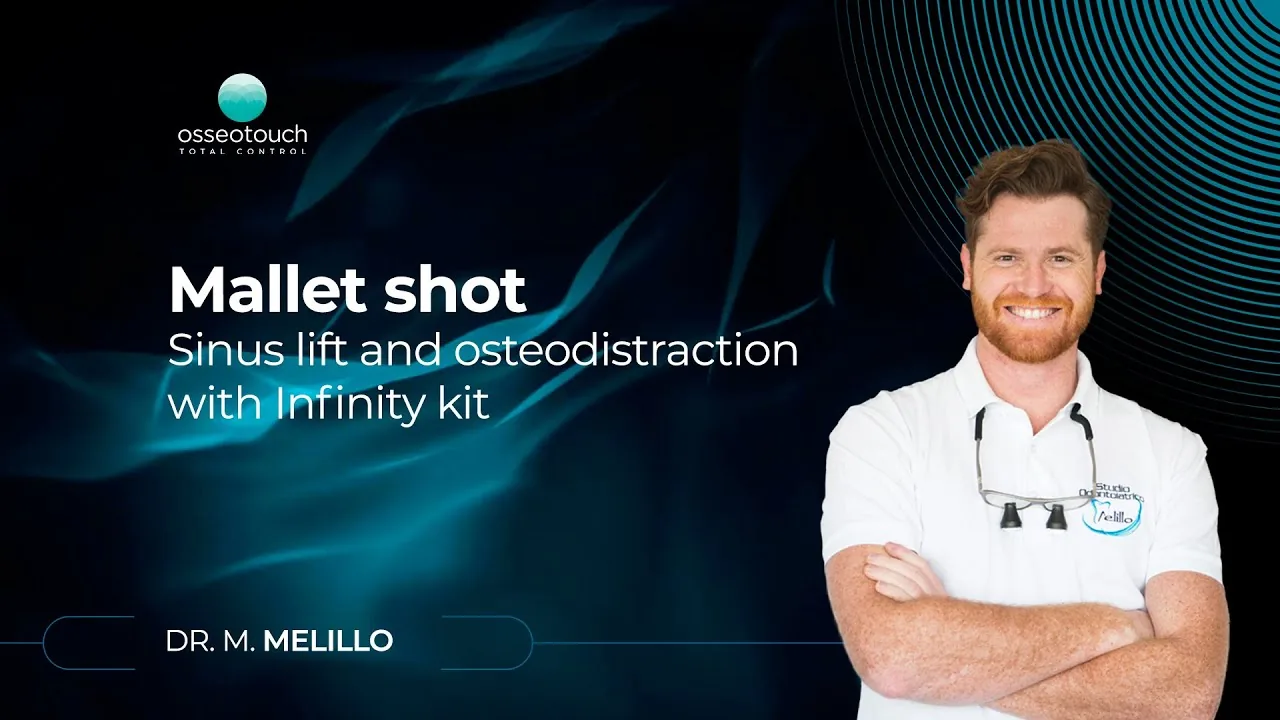 Webinar Dr. Melillo — Sinus lift and osteodistraction with Infinity kit